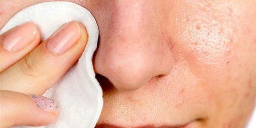 أفضل
      الطرق
      للتخلص
      من
      الرؤوس
      السوداء
      في
      المنزل
      باستخدام
      مكونات
      طبيعية - نجد الاخبارية